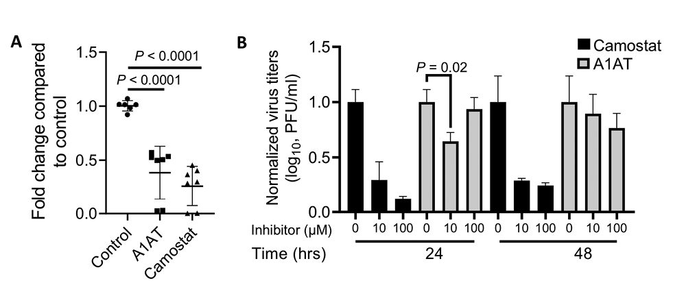 Alpha 1 Antitrypsin is an Inhibitor of the SARS-CoV-2–Priming